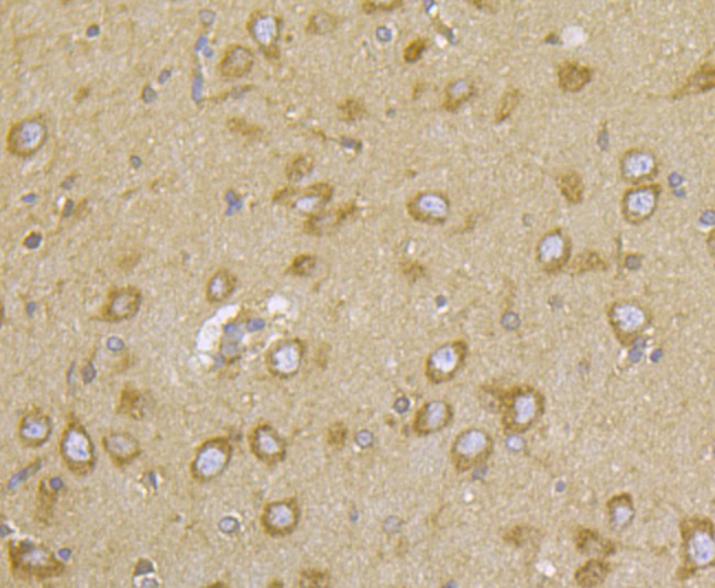 Immunohistochemical analysis of paraffin-embedded rat brain tissue using anti-CASK antibody. Counter stained with hematoxylin.