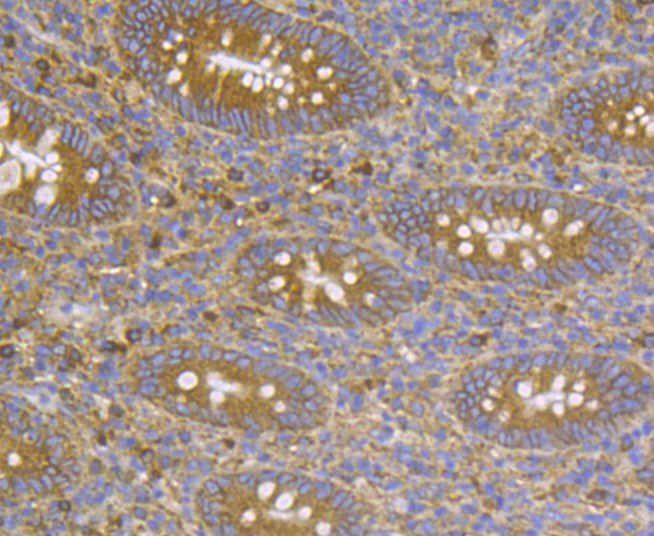 Immunohistochemical analysis of paraffin-embedded human appendix tissue using anti-CASK antibody. Counter stained with hematoxylin.