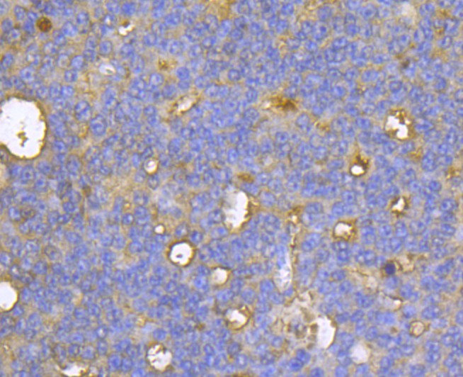Immunohistochemical analysis of paraffin-embedded human appendix tissue using anti-CASK antibody. Counter stained with hematoxylin.