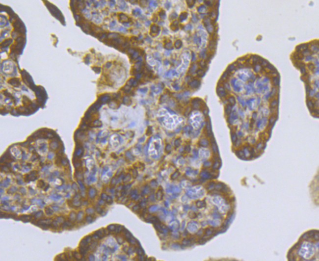 Immunohistochemical analysis of paraffin-embedded human placenta tissue using anti-CASK antibody. Counter stained with hematoxylin.