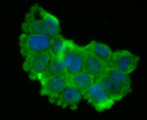 ICC staining SDHB in 293T cells (green). The nuclear counter stain is DAPI (blue). Cells were fixed in paraformaldehyde, permeabilised with 0.25% Triton X100/PBS.