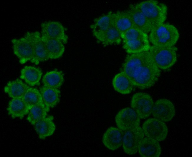 ICC staining SDHB in HT-29 cells (green). The nuclear counter stain is DAPI (blue). Cells were fixed in paraformaldehyde, permeabilised with 0.25% Triton X100/PBS.