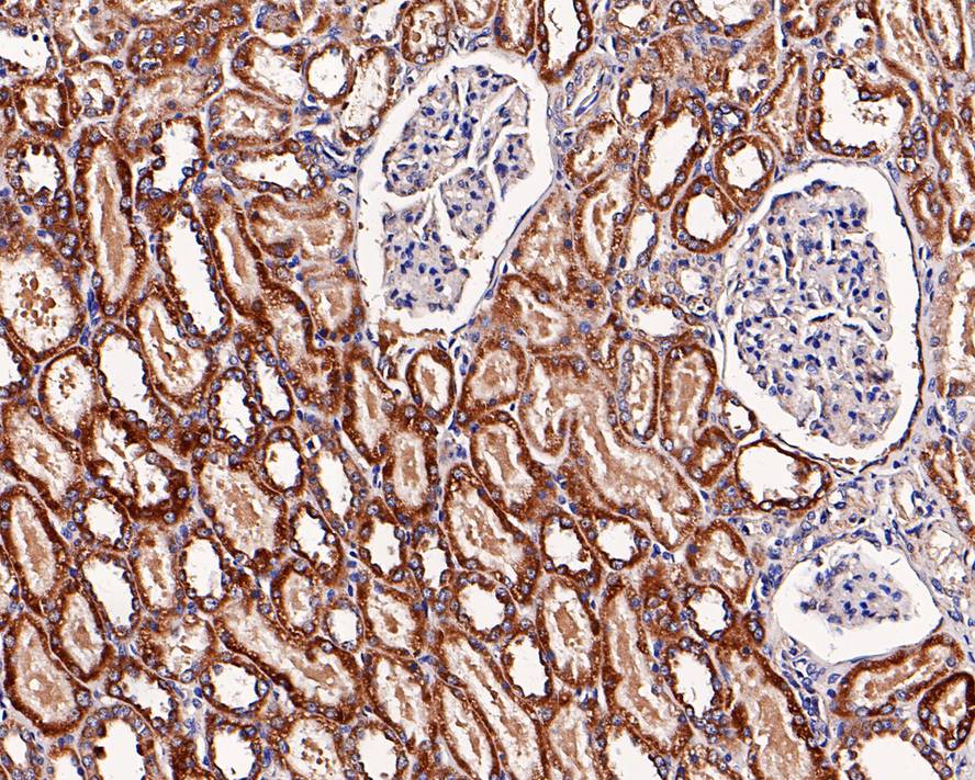 Immunohistochemical analysis of paraffin-embedded human kidney tissue with Rabbit anti-SDHB antibody (ER1803-63) at 1/200 dilution.<br />
<br />
The section was pre-treated using heat mediated antigen retrieval with Tris-EDTA buffer (pH 9.0) for 20 minutes. The tissues were blocked in 1% BSA for 20 minutes at room temperature, washed with ddH2O and PBS, and then probed with the primary antibody (ER1803-63) at 1/200 dilution for 1 hour at room temperature. The detection was performed using an HRP conjugated compact polymer system. DAB was used as the chromogen. Tissues were counterstained with hematoxylin and mounted with DPX.