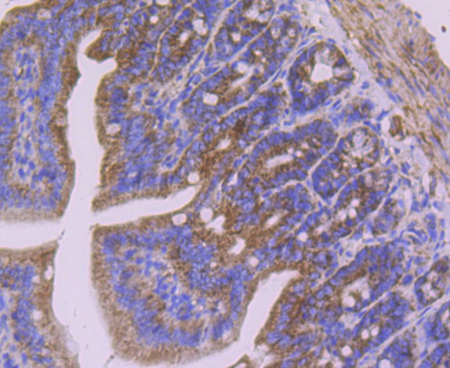 Immunohistochemical analysis of paraffin-embedded mouse colon tissue using anti-SDHB antibody. Counter stained with hematoxylin.
