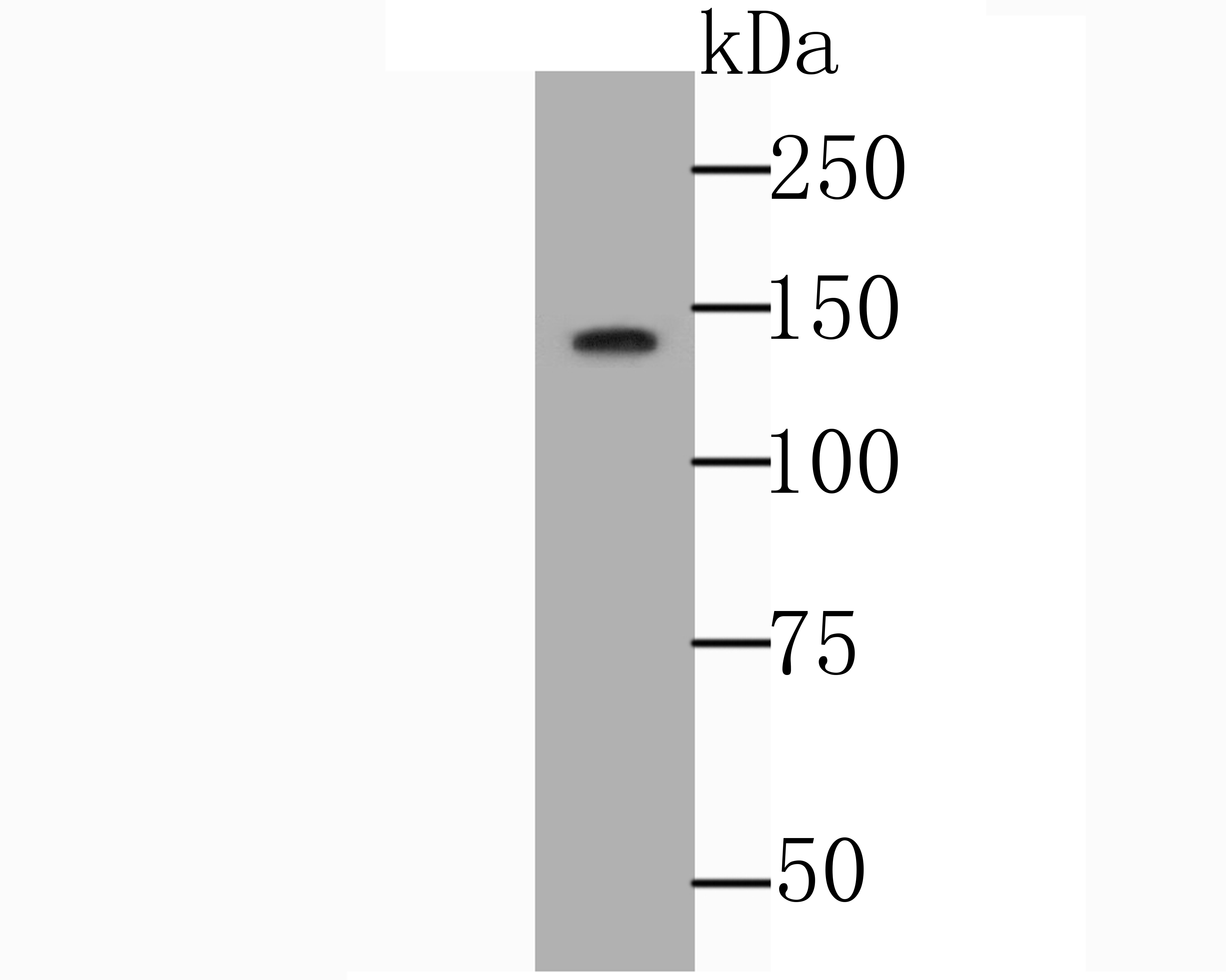 Western blot analysis of NRCAM on SH-SY5Y cell lysate using anti-NRCAM antibody at 1/1,000 dilution.
