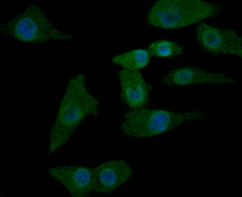 ICC staining NRCAM in A549 cells (green). The nuclear counter stain is DAPI (blue). Cells were fixed in paraformaldehyde, permeabilised with 0.25% Triton X100/PBS.