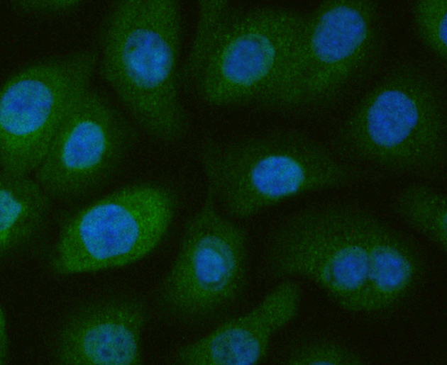 ICC staining NRCAM in SKOV-3 cells (green). The nuclear counter stain is DAPI (blue). Cells were fixed in paraformaldehyde, permeabilised with 0.25% Triton X100/PBS.