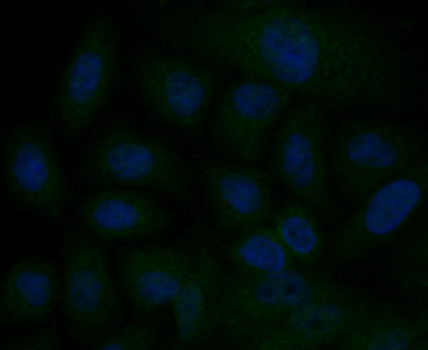 ICC staining ITPR2 in HepG2 cells (green). The nuclear counter stain is DAPI (blue). Cells were fixed in paraformaldehyde, permeabilised with 0.25% Triton X100/PBS.