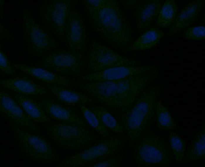 ICC staining ITPR2 in SiHa cells (green). The nuclear counter stain is DAPI (blue). Cells were fixed in paraformaldehyde, permeabilised with 0.25% Triton X100/PBS.