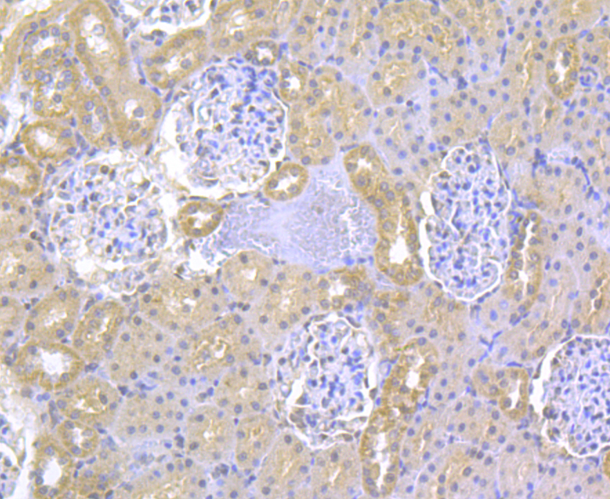 Immunohistochemical analysis of paraffin-embedded rat kidney tissue using anti-ITPR2 antibody. Counter stained with hematoxylin.