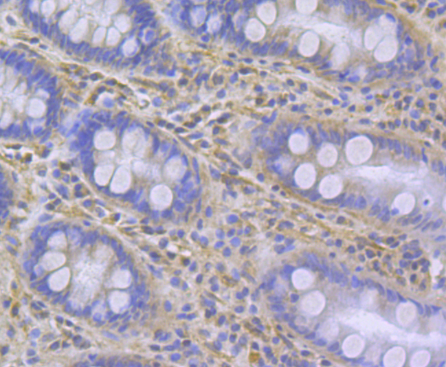 Immunohistochemical analysis of paraffin-embedded human colon tissue using anti-ITPR2 antibody. Counter stained with hematoxylin.