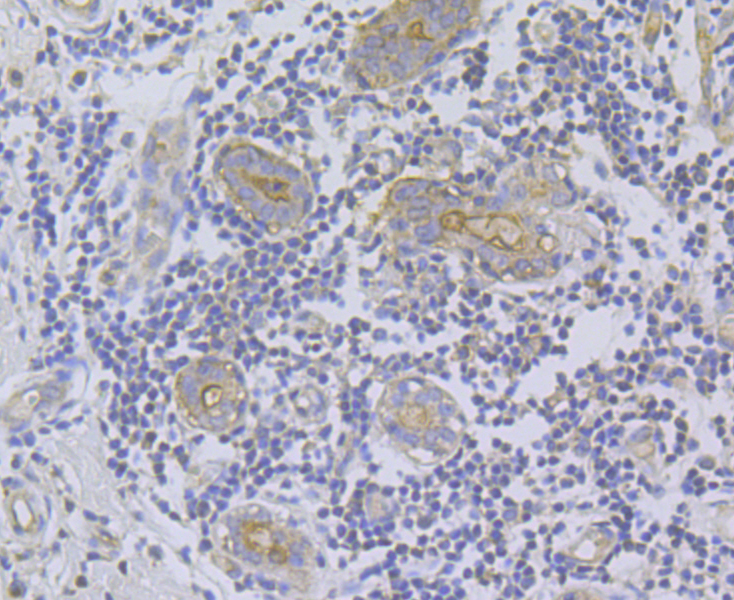 Immunohistochemical analysis of paraffin-embedded human breast tissue using anti-ITPR2 antibody. Counter stained with hematoxylin.