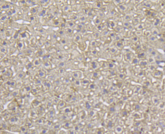 Immunohistochemical analysis of paraffin-embedded mouse liver tissue using anti-ITPR2 antibody. Counter stained with hematoxylin.