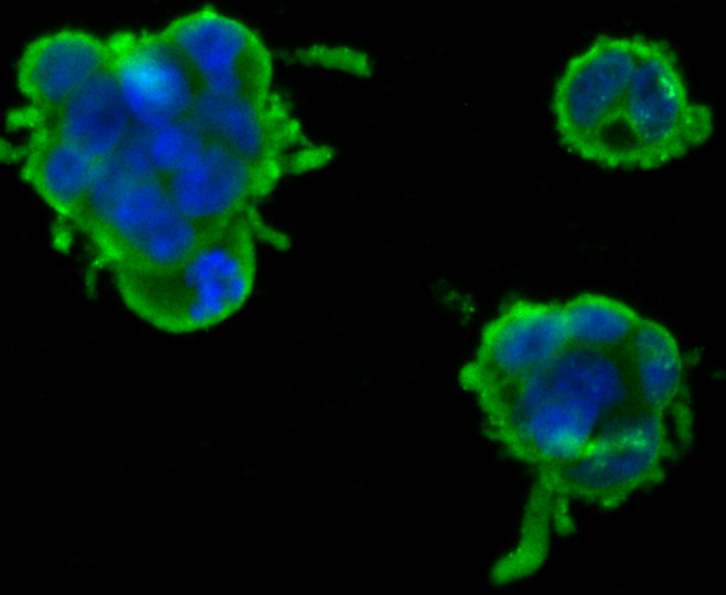 ICC staining Nephrin in 293T cells (green). Formalin fixed cells were permeabilized with 0.1% Triton X-100 in TBS for 10 minutes at room temperature and blocked with 1% Blocker BSA for 15 minutes at room temperature. Cells were probed with Nephrin polyclonal antibody at a dilution of 1:100 for at least 1 hour at room temperature, washed with PBS. Alexa Fluorc™ 488 Goat anti-Rabbit IgG was used as the secondary antibody at 1/100 dilution. The nuclear counter stain is DAPI (blue).