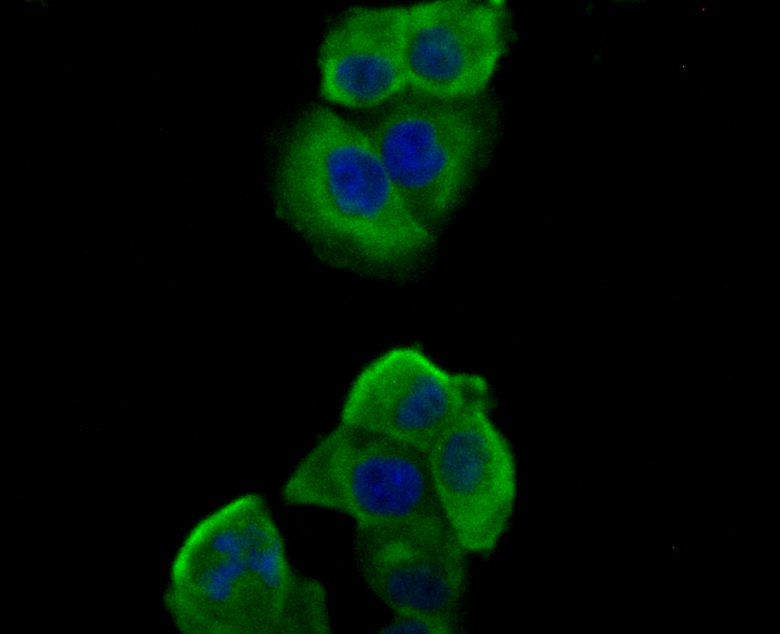 ICC staining Nephrin in PANC-1 cells (green). Formalin fixed cells were permeabilized with 0.1% Triton X-100 in TBS for 10 minutes at room temperature and blocked with 1% Blocker BSA for 15 minutes at room temperature. Cells were probed with Nephrin polyclonal antibody at a dilution of 1:100 for at least 1 hour at room temperature, washed with PBS. Alexa Fluorc™ 488 Goat anti-Rabbit IgG was used as the secondary antibody at 1/100 dilution. The nuclear counter stain is DAPI (blue).