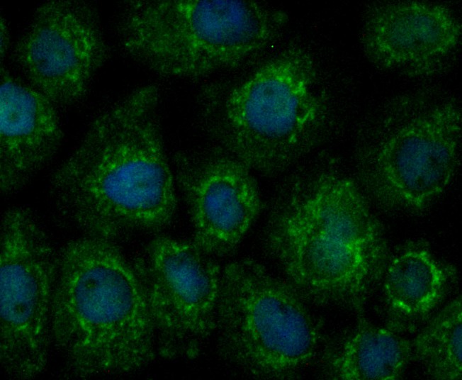 ICC staining Annexin A1 in A431 cells (green). Formalin fixed cells were permeabilized with 0.1% Triton X-100 in TBS for 10 minutes at room temperature and blocked with 1% Blocker BSA for 15 minutes at room temperature. Cells were probed with Annexin A1 polyclonal antibody at a dilution of 1/200 for at least 1 hour at room temperature, washed with PBS. Alexa Fluor™ 488 Goat anti-Rabbit IgG was used as the secondary antibody at 1/100 dilution. The nuclear counter stain is DAPI (blue).