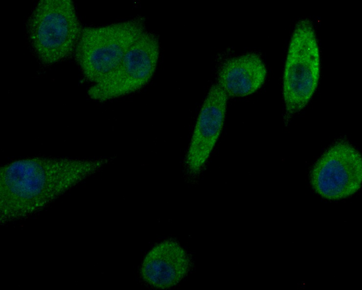 ICC staining Prolactin/PRL in A549 cells (green). Formalin fixed cells were permeabilized with 0.1% Triton X-100 in TBS for 10 minutes at room temperature and blocked with 1% Blocker BSA for 15 minutes at room temperature. Cells were probed with Prolactin/PRL polyclonal antibody at a dilution of 1:50 for 1 hour at room temperature, washed with PBS. Alexa Fluorc™ 488 Goat anti-Rabbit IgG was used as the secondary antibody at 1/100 dilution. The nuclear counter stain is DAPI (blue).