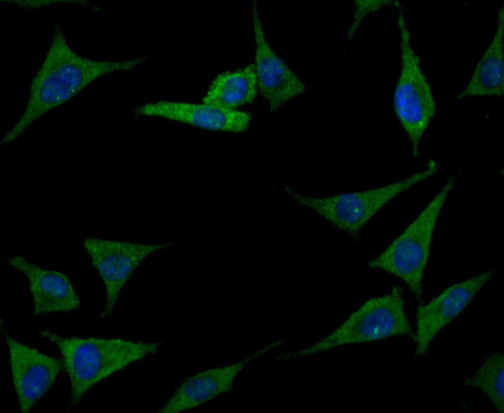 ICC staining Prolactin/PRL in SH-SY-5Y cells (green). Formalin fixed cells were permeabilized with 0.1% Triton X-100 in TBS for 10 minutes at room temperature and blocked with 1% Blocker BSA for 15 minutes at room temperature. Cells were probed with Prolactin/PRL polyclonal antibody at a dilution of 1/50 for 1 hour at room temperature, washed with PBS. Alexa Fluor™ 488 Goat anti-Rabbit IgG was used as the secondary antibody at 1/100 dilution. The nuclear counter stain is DAPI (blue).