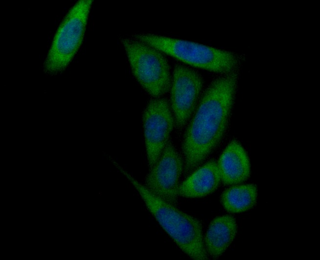 ICC staining Prolactin/PRL in SiHa cells (green). Formalin fixed cells were permeabilized with 0.1% Triton X-100 in TBS for 10 minutes at room temperature and blocked with 1% Blocker BSA for 15 minutes at room temperature. Cells were probed with Prolactin/PRL polyclonal antibody at a dilution of 1:100 for 1 hour at room temperature, washed with PBS. Alexa Fluorc™ 488 Goat anti-Rabbit IgG was used as the secondary antibody at 1/100 dilution. The nuclear counter stain is DAPI (blue).