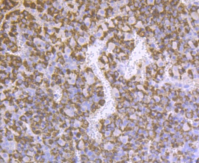 Immunohistochemical analysis of paraffin-embedded rat pituitary tissue using anti-Prolactin/PRL antibody. The section was pre-treated using heat mediated antigen retrieval with sodium citrate buffer (pH 6.0) for 20 minutes. The tissues were blocked in 5% BSA for 30 minutes at room temperature, washed with ddH2O and PBS, and then probed with the antibody (ER1803-72) at 1/200 dilution, for 30 minutes at room temperature and detected using an HRP conjugated compact polymer system. DAB was used as the chrogen. Counter stained with hematoxylin and mounted with DPX.