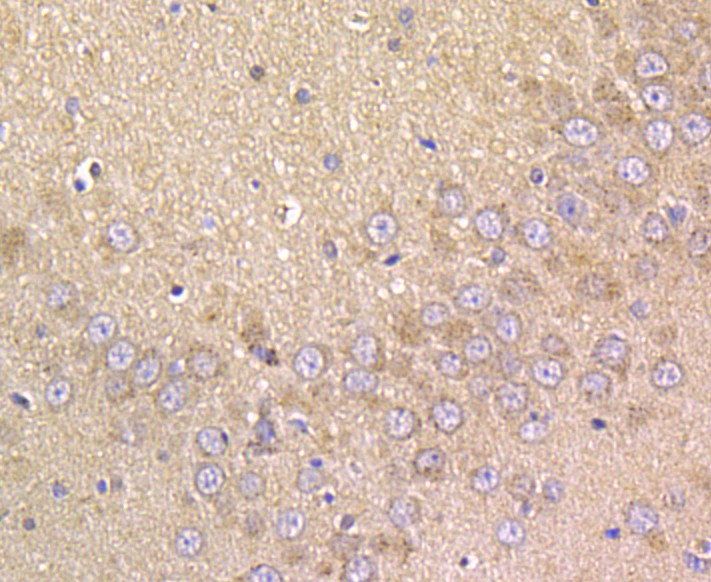Immunohistochemical analysis of paraffin-embedded rat brain tissue using anti-Prolactin/PRL antibody. The section was pre-treated using heat mediated antigen retrieval with sodium citrate buffer (pH 6.0) for 20 minutes. The tissues were blocked in 5% BSA for 30 minutes at room temperature, washed with ddH2O and PBS, and then probed with the antibody (ER1803-72) at 1/50 dilution, for 30 minutes at room temperature and detected using an HRP conjugated compact polymer system. DAB was used as the chrogen. Counter stained with hematoxylin and mounted with DPX.