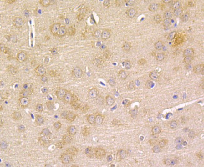 Immunohistochemical analysis of paraffin-embedded mouse brain tissue using anti-Prolactin/PRL antibody. The section was pre-treated using heat mediated antigen retrieval with sodium citrate buffer (pH 6.0) for 20 minutes. The tissues were blocked in 5% BSA for 30 minutes at room temperature, washed with ddH2O and PBS, and then probed with the antibody (ER1803-72) at 1/50 dilution, for 30 minutes at room temperature and detected using an HRP conjugated compact polymer system. DAB was used as the chrogen. Counter stained with hematoxylin and mounted with DPX.