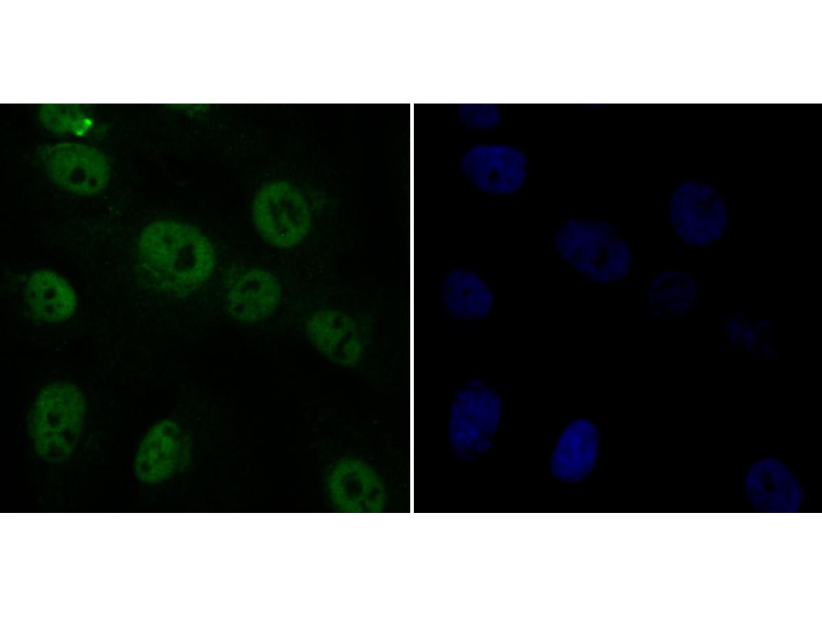 ICC staining of Rad21 in MG-63 cells (green). Formalin fixed cells were permeabilized with 0.1% Triton X-100 in TBS for 10 minutes at room temperature and blocked with 10% negative goat serum for 15 minutes at room temperature. Cells were probed with the primary antibody (ER1803-73, 1/50) for 1 hour at room temperature, washed with PBS. Alexa Fluor®488 conjugate-Goat anti-Rabbit IgG was used as the secondary antibody at 1/1,000 dilution. The nuclear counter stain is DAPI (blue).