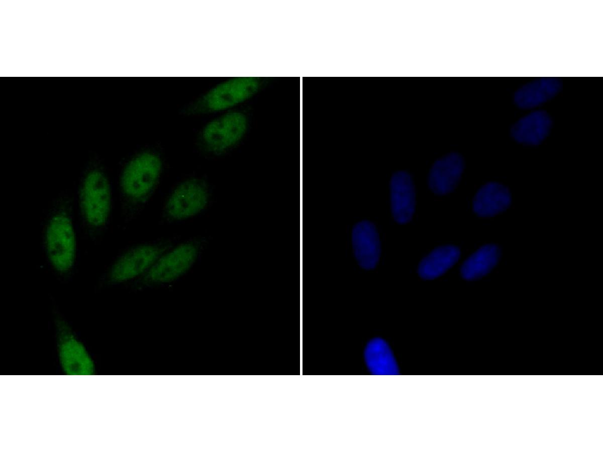 ICC staining of Rad21 in SiHa cells (green). Formalin fixed cells were permeabilized with 0.1% Triton X-100 in TBS for 10 minutes at room temperature and blocked with 10% negative goat serum for 15 minutes at room temperature. Cells were probed with the primary antibody (ER1803-73, 1/50) for 1 hour at room temperature, washed with PBS. Alexa Fluor®488 conjugate-Goat anti-Rabbit IgG was used as the secondary antibody at 1/1,000 dilution. The nuclear counter stain is DAPI (blue).