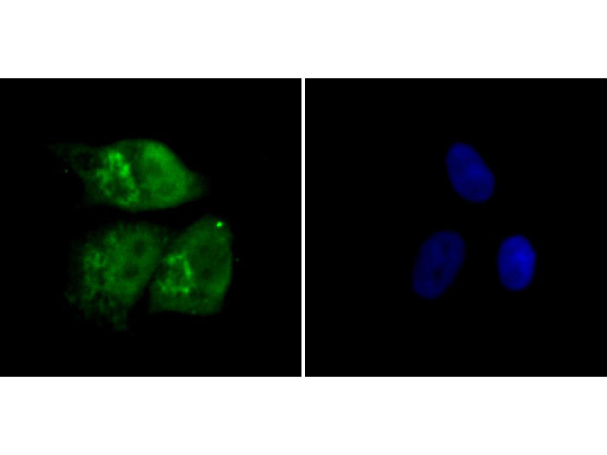 ICC staining of Rad21 in SK-Br-3 cells (green). Formalin fixed cells were permeabilized with 0.1% Triton X-100 in TBS for 10 minutes at room temperature and blocked with 10% negative goat serum for 15 minutes at room temperature. Cells were probed with the primary antibody (ER1803-73, 1/50) for 1 hour at room temperature, washed with PBS. Alexa Fluor®488 conjugate-Goat anti-Rabbit IgG was used as the secondary antibody at 1/1,000 dilution. The nuclear counter stain is DAPI (blue).