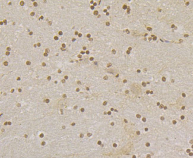 Immunohistochemical analysis of paraffin-embedded rat brain tissue using anti-Rad21 antibody. The section was pre-treated using heat mediated antigen retrieval with sodium citrate buffer (pH 6.0) for 20 minutes. The tissues were blocked in 1% BSA for 30 minutes at room temperature, washed with ddH2O and PBS, and then probed with the primary antibody (ER1803-73, 1/200)  for 30 minutes at room temperature. The detection was performed using an HRP conjugated compact polymer system. DAB was used as the chromogen. Tissues were counterstained with hematoxylin and mounted with DPX.