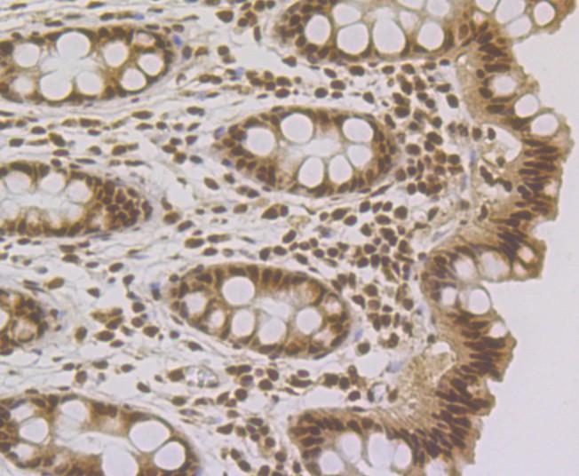 Immunohistochemical analysis of paraffin-embedded human colon tissue using anti-Rad21 antibody. The section was pre-treated using heat mediated antigen retrieval with sodium citrate buffer (pH 6.0) for 20 minutes. The tissues were blocked in 1% BSA for 30 minutes at room temperature, washed with ddH2O and PBS, and then probed with the primary antibody (ER1803-73, 1/200)  for 30 minutes at room temperature. The detection was performed using an HRP conjugated compact polymer system. DAB was used as the chromogen. Tissues were counterstained with hematoxylin and mounted with DPX.
