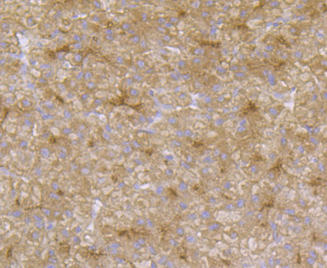 Immunohistochemical analysis of paraffin-embedded human liver tissue using anti-CD13 antibody. The section was pre-treated using heat mediated antigen retrieval with Tris-EDTA buffer (pH 8.0-8.4) for 20 minutes.The tissues were blocked in 5% BSA for 30 minutes at room temperature, washed with ddH2O and PBS, and then probed with the antibody (ER1803-74) at 1/50 dilution, for 30 minutes at room temperature and detected using an HRP conjugated compact polymer system. DAB was used as the chrogen. Counter stained with hematoxylin and mounted with DPX.