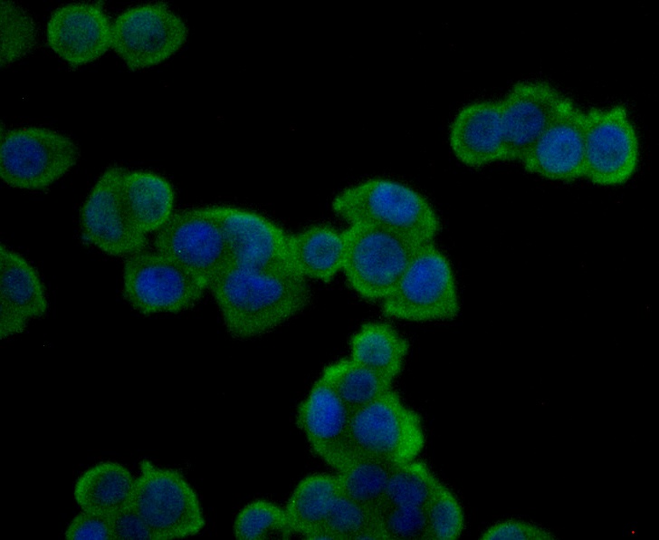 ICC staining ACY-1 in HT-29 cells (green). Formalin fixed cells were permeabilized with 0.1% Triton X-100 in TBS for 10 minutes at room temperature and blocked with 1% Blocker BSA for 15 minutes at room temperature. Cells were probed with ACY-1 polyclonal antibody at a dilution of 1:200 for 1 hour at room temperature, washed with PBS. Alexa Fluor™ 488 Goat anti-Rabbit IgG was used as the secondary antibody at 1/100 dilution. The nuclear counter stain is DAPI (blue).