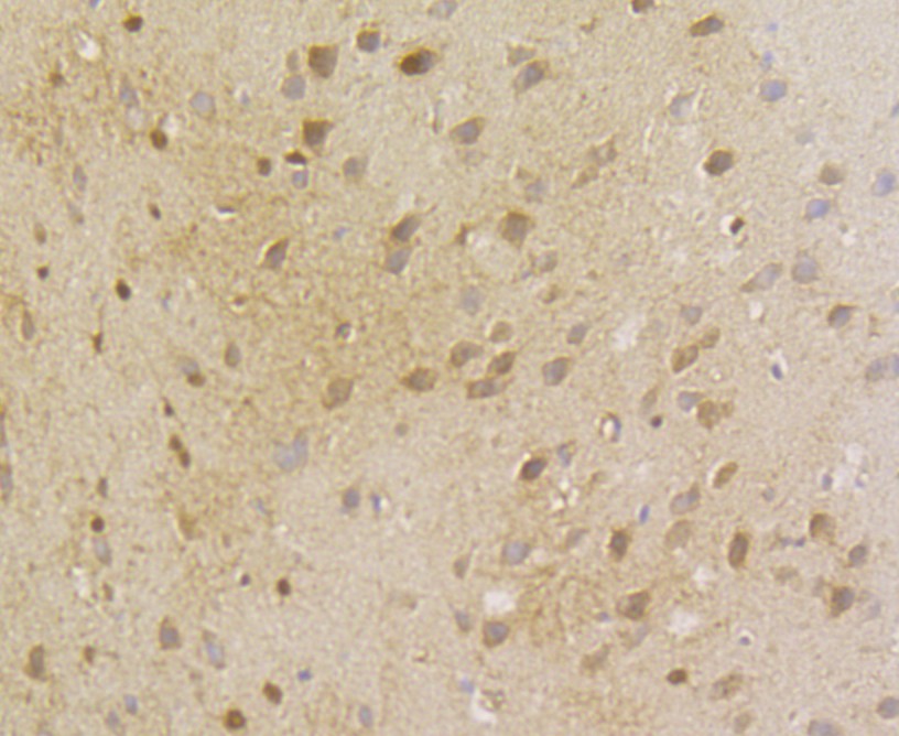 Immunohistochemical analysis of paraffin-embedded rat brain tissue using anti-ACY-1 antibody. The section was pre-treated using heat mediated antigen retrieval with Tris-EDTA buffer (pH 8.0-8.4) for 20 minutes.The tissues were blocked in 5% BSA for 30 minutes at room temperature, washed with ddH2O and PBS, and then probed with the antibody (ER1803-75) at 1/200 dilution, for 30 minutes at room temperature and detected using an HRP conjugated compact polymer system. DAB was used as the chrogen. Counter stained with hematoxylin and mounted with DPX.