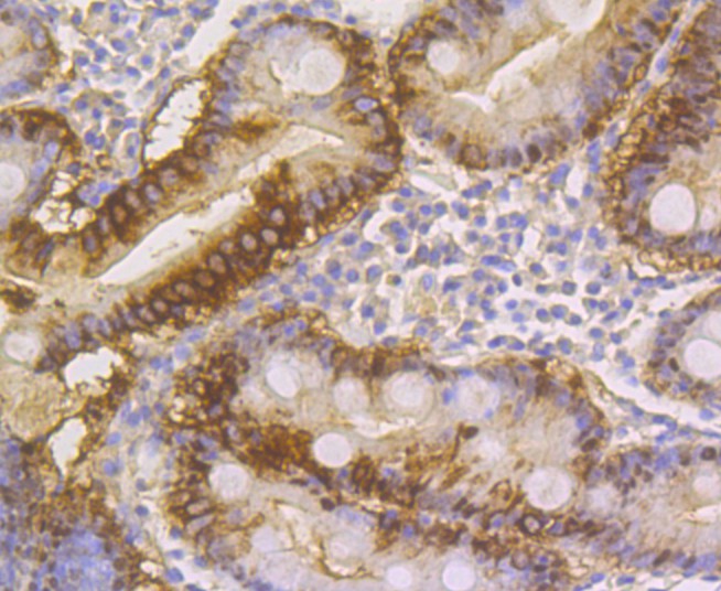 Immunohistochemical analysis of paraffin-embedded human small intestine tissue using anti-ACY-1 antibody. The section was pre-treated using heat mediated antigen retrieval with Tris-EDTA buffer (pH 8.0-8.4) for 20 minutes.The tissues were blocked in 5% BSA for 30 minutes at room temperature, washed with ddH2O and PBS, and then probed with the antibody (ER1803-75) at 1/200 dilution, for 30 minutes at room temperature and detected using an HRP conjugated compact polymer system. DAB was used as the chrogen. Counter stained with hematoxylin and mounted with DPX.