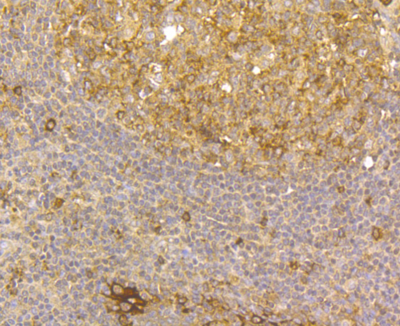 Immunohistochemical analysis of paraffin-embedded human tonsil tissue using anti-Mesothelin antibody. The section was pre-treated using heat mediated antigen retrieval with Tris-EDTA buffer (pH 8.0-8.4) for 20 minutes. The tissues were blocked in 5% BSA for 30 minutes at room temperature, washed with ddH2O and PBS, and then probed with the antibody (ER1803-76) at 1/100 dilution, for 30 minutes at room temperature and detected using an HRP conjugated compact polymer system. DAB was used as the chrogen. Counter stained with hematoxylin and mounted with DPX.