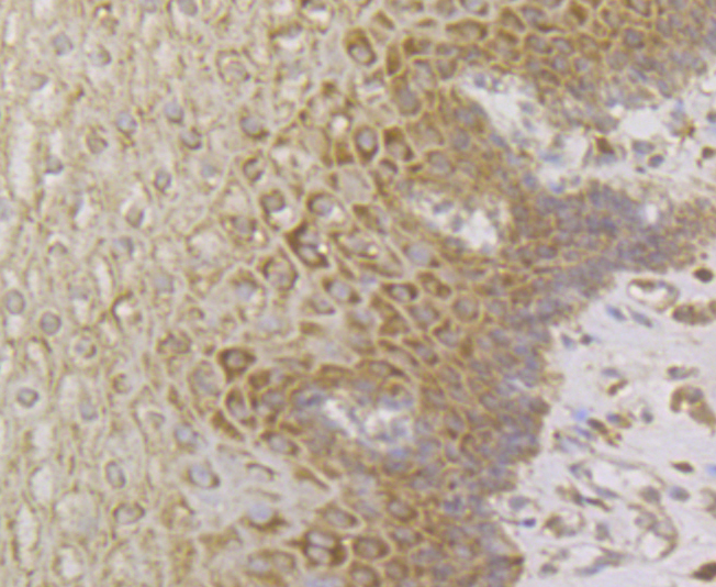 Immunohistochemical analysis of paraffin-embedded human esophagus tissue using anti-Perforin antibody. The section was pre-treated using heat mediated antigen retrieval with sodium citrate buffer (pH 6.0) for 20 minutes. The tissues were blocked in 5% BSA for 30 minutes at room temperature, washed with ddH2O and PBS, and then probed with the antibody (ER1803-77) at 1/200 dilution, for 30 minutes at room temperature and detected using an HRP conjugated compact polymer system. DAB was used as the chrogen. Counter stained with hematoxylin and mounted with DPX.