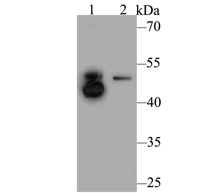 Western blot analysis of Integrin linked ILK on different lysates. Proteins were transferred to a PVDF membrane and blocked with 5% BSA in PBS for 1 hour at room temperature. The primary antibody was used at a 1:500 dilution in 5% BSA at room temperature for 2 hours. Goat Anti-Rabbit IgG - HRP Secondary Antibody (HA1001) at 1:5,000 dilution was used for 1 hour at room temperature.<br />
Positive control: <br />
Lane 1: Mouse skeletal muscle tissue lysate<br />
Lane 2: Rat lung tissue lysate
