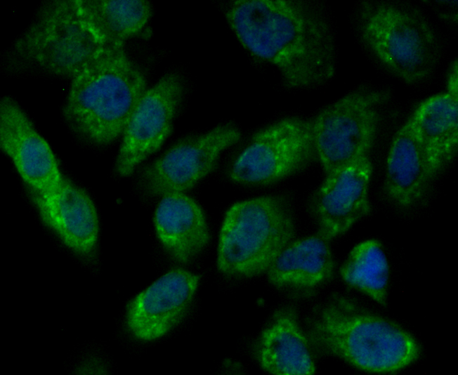 ICC staining Integrin linked ILK in A431 cells (green). Formalin fixed cells were permeabilized with 0.1% Triton X-100 in TBS for 10 minutes at room temperature and blocked with 1% Blocker BSA for 15 minutes at room temperature. Cells were probed with Integrin linked ILK polyclonal antibody at a dilution of 1:100 for 1 hour at room temperature, washed with PBS. Alexa Fluorc™ 488 Goat anti-Rabbit IgG was used as the secondary antibody at 1/100 dilution. The nuclear counter stain is DAPI (blue).