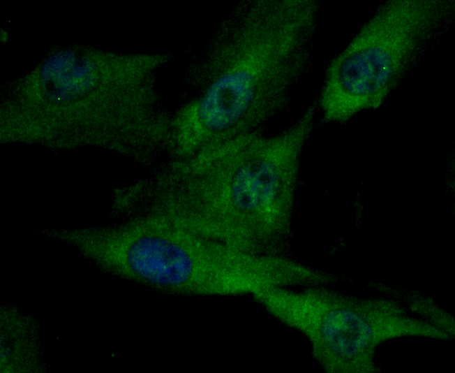 ICC staining Integrin linked ILK in MG-63 cells (green). Formalin fixed cells were permeabilized with 0.1% Triton X-100 in TBS for 10 minutes at room temperature and blocked with 1% Blocker BSA for 15 minutes at room temperature. Cells were probed with Integrin linked ILK polyclonal antibody at a dilution of 1:50 for 1 hour at room temperature, washed with PBS. Alexa Fluorc™ 488 Goat anti-Rabbit IgG was used as the secondary antibody at 1/100 dilution. The nuclear counter stain is DAPI (blue).