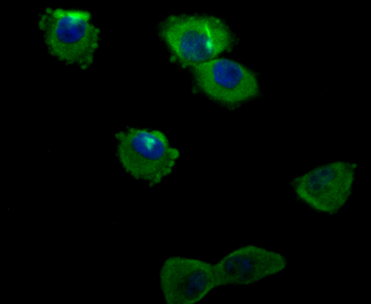 ICC staining Integrin linked ILK in PANC-1 cells (green). Formalin fixed cells were permeabilized with 0.1% Triton X-100 in TBS for 10 minutes at room temperature and blocked with 1% Blocker BSA for 15 minutes at room temperature. Cells were probed with Integrin linked ILK polyclonal antibody at a dilution of 1:50 for 1 hour at room temperature, washed with PBS. Alexa Fluorc™ 488 Goat anti-Rabbit IgG was used as the secondary antibody at 1/100 dilution. The nuclear counter stain is DAPI (blue).