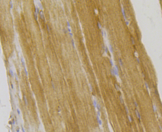 Immunohistochemical analysis of paraffin-embedded rat skeletal muscle tissue using anti-Integrin linked ILK antibody. The section was pre-treated using heat mediated antigen retrieval with Tris-EDTA buffer (pH 8.0-8.4) for 20 minutes.The tissues were blocked in 5% BSA for 30 minutes at room temperature, washed with ddH2O and PBS, and then probed with the antibody (ER1803-78) at 1/200 dilution, for 30 minutes at room temperature and detected using an HRP conjugated compact polymer system. DAB was used as the chrogen. Counter stained with hematoxylin and mounted with DPX.