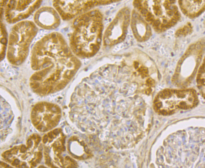 Immunohistochemical analysis of paraffin-embedded human kidney tissue using anti-Integrin linked ILK antibody. The section was pre-treated using heat mediated antigen retrieval with Tris-EDTA buffer (pH 8.0-8.4) for 20 minutes.The tissues were blocked in 5% BSA for 30 minutes at room temperature, washed with ddH2O and PBS, and then probed with the antibody (ER1803-78) at 1/200 dilution, for 30 minutes at room temperature and detected using an HRP conjugated compact polymer system. DAB was used as the chrogen. Counter stained with hematoxylin and mounted with DPX.