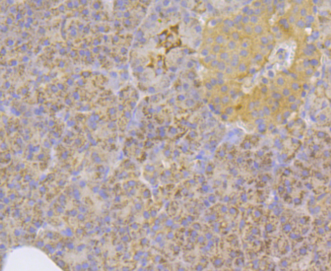 Immunohistochemical analysis of paraffin-embedded human pancreas tissue using anti-Integrin linked ILK antibody. The section was pre-treated using heat mediated antigen retrieval with Tris-EDTA buffer (pH 8.0-8.4) for 20 minutes.The tissues were blocked in 5% BSA for 30 minutes at room temperature, washed with ddH2O and PBS, and then probed with the antibody (ER1803-78) at 1/200 dilution, for 30 minutes at room temperature and detected using an HRP conjugated compact polymer system. DAB was used as the chrogen. Counter stained with hematoxylin and mounted with DPX.