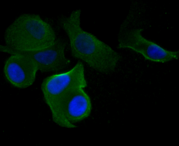 ICC staining Cytokeratin 19 in SK-Br-3 cells (green). Formalin fixed cells were permeabilized with 0.1% Triton X-100 in TBS for 10 minutes at room temperature and blocked with 1% Blocker BSA for 15 minutes at room temperature. Cells were probed with Cytokeratin 19 polyclonal antibody at a dilution of 1:50 for 1 hour at room temperature, washed with PBS. Alexa Fluorc™ 488 Goat anti-Rabbit IgG was used as the secondary antibody at 1/100 dilution. The nuclear counter stain is DAPI (blue).