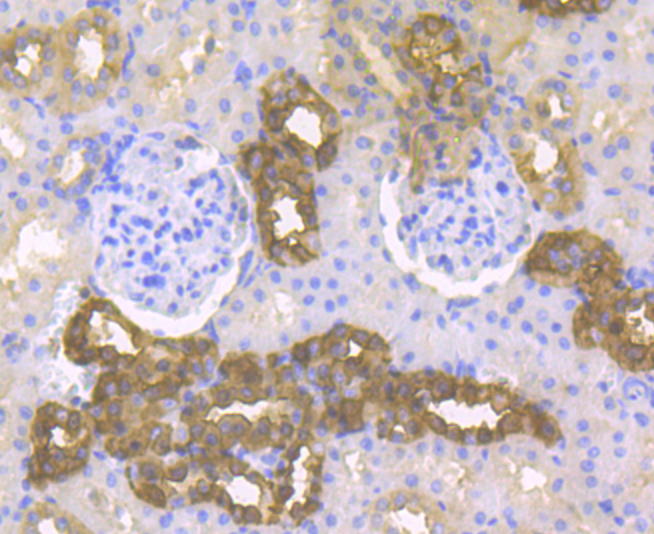 Immunohistochemical analysis of paraffin-embedded rat kidney tissue using anti-Cytokeratin 19 antibody. The section was pre-treated using heat mediated antigen retrieval with sodium citrate buffer (pH 6.0) for 20 minutes. The tissues were blocked in 5% BSA for 30 minutes at room temperature, washed with ddH2O and PBS, and then probed with the antibody (ER1803-79) at 1/200 dilution, for 30 minutes at room temperature and detected using an HRP conjugated compact polymer system. DAB was used as the chrogen. Counter stained with hematoxylin and mounted with DPX.