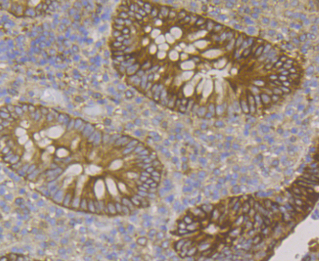 Immunohistochemical analysis of paraffin-embedded human appendix tissue using anti-Cytokeratin 19 antibody. The section was pre-treated using heat mediated antigen retrieval with sodium citrate buffer (pH 6.0) for 20 minutes. The tissues were blocked in 5% BSA for 30 minutes at room temperature, washed with ddH2O and PBS, and then probed with the antibody (ER1803-79) at 1/200 dilution, for 30 minutes at room temperature and detected using an HRP conjugated compact polymer system. DAB was used as the chrogen. Counter stained with hematoxylin and mounted with DPX.