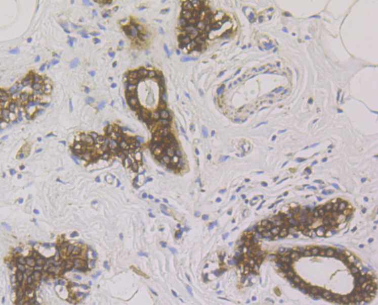 Immunohistochemical analysis of paraffin-embedded human breast tissue using anti-Cytokeratin 19 antibody. The section was pre-treated using heat mediated antigen retrieval with sodium citrate buffer (pH 6.0) for 20 minutes. The tissues were blocked in 5% BSA for 30 minutes at room temperature, washed with ddH2O and PBS, and then probed with the antibody (ER1803-79) at 1/200 dilution, for 30 minutes at room temperature and detected using an HRP conjugated compact polymer system. DAB was used as the chrogen. Counter stained with hematoxylin and mounted with DPX.
