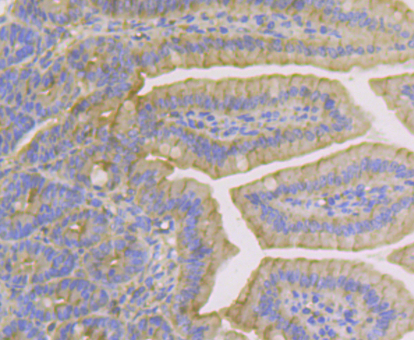 Immunohistochemical analysis of paraffin-embedded mouse colon tissue using anti-Cytokeratin 19 antibody. The section was pre-treated using heat mediated antigen retrieval with sodium citrate buffer (pH 6.0) for 20 minutes. The tissues were blocked in 5% BSA for 30 minutes at room temperature, washed with ddH2O and PBS, and then probed with the antibody (ER1803-79) at 1/200 dilution, for 30 minutes at room temperature and detected using an HRP conjugated compact polymer system. DAB was used as the chrogen. Counter stained with hematoxylin and mounted with DPX.