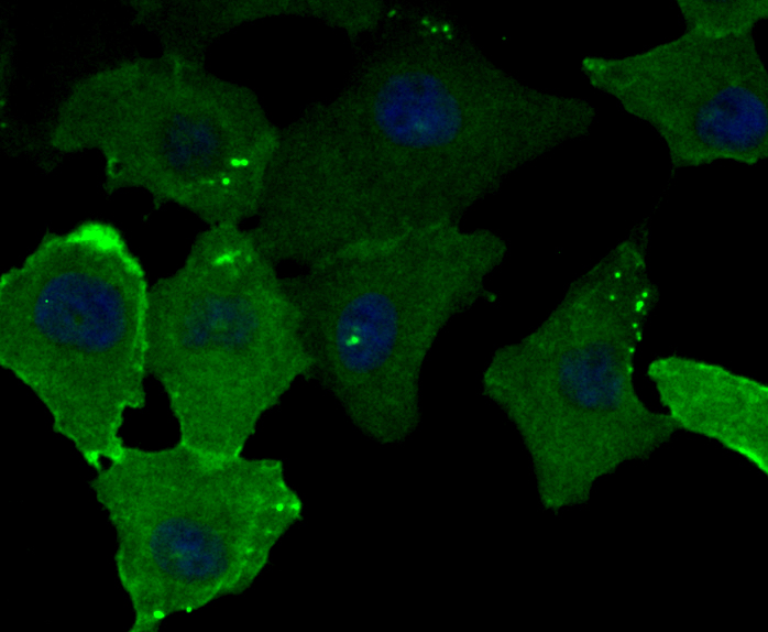 ICC staining CD99 in A549 cells (green). Formalin fixed cells were permeabilized with 0.1% Triton X-100 in TBS for 10 minutes at room temperature and blocked with 1% Blocker BSA for 15 minutes at room temperature. Cells were probed with the antibody (ER1803-81) at a dilution of 1:100 for 1 hour at room temperature, washed with PBS. Alexa Fluorc™ 488 Goat anti-Rabbit IgG was used as the secondary antibody at 1/100 dilution. The nuclear counter stain is DAPI (blue).